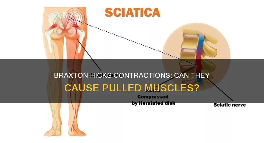 can braxton hicks contractions cause a pulled muscle