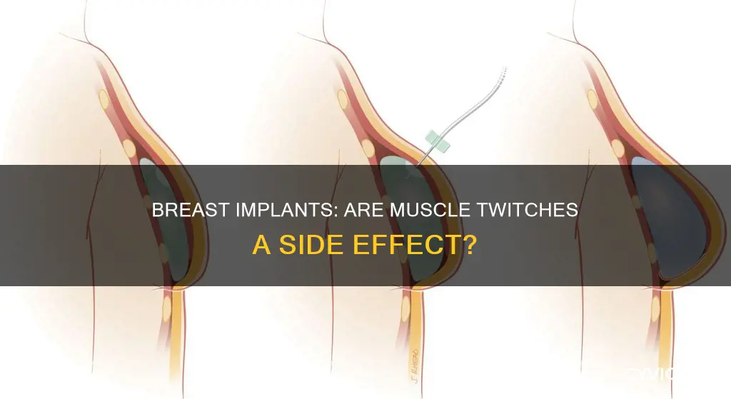 can breast implants cause muscle twitching