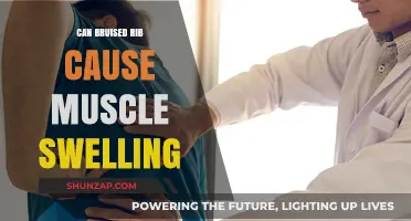 Bruised Ribs: Understanding Muscle Swelling and Its Causes