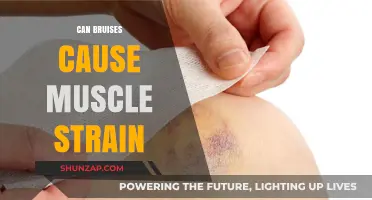 Bruises and Muscle Strains: What's the Link?