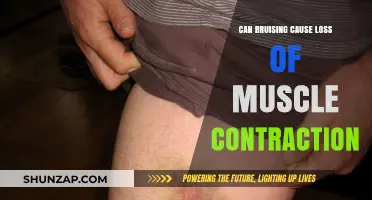 How Bruising Impacts Muscle Contraction and Movement