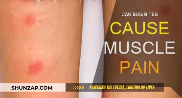 Bug Bites: Unseen Cause of Muscle Pain