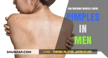Muscle Gain and Pimples: Is There a Link?