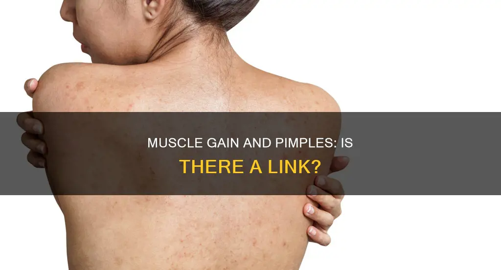 can building muscle cause pimples in men