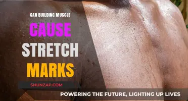 Building Muscle: Stretch Marks' Causes and Cures