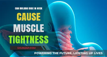 Neck Disc Bulge: How it Causes Muscle Tightness