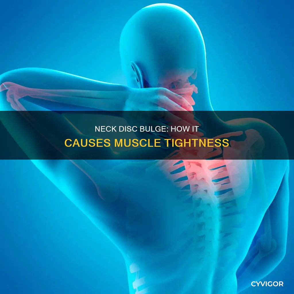 can bulging disc in neck cause muscle tightness