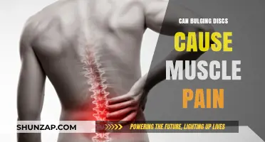 Bulging Discs: The Cause of Your Muscle Pain?