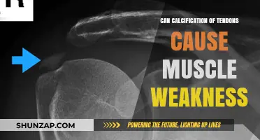 Tendons, Calcification, and Muscle Weakness: What's the Link?