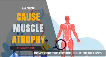 Cancer's Impact: Muscle Atrophy Explained