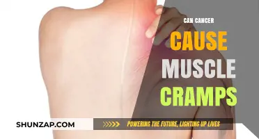 Cancer's Link to Muscle Cramps: What's the Truth?