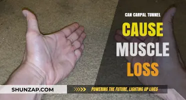 Carpal Tunnel Syndrome: Muscle Loss and Weakness