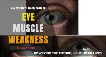 Cataract Surgery: Can It Weaken Eye Muscles?