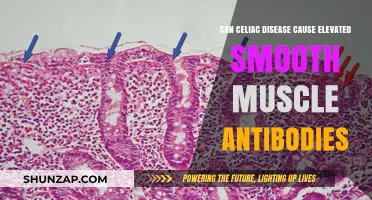 Smooth Muscle Antibodies: Celiac Disease Link Explored