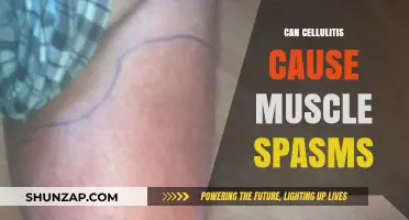 Cellulitis and Muscle Spasms: What's the Connection?