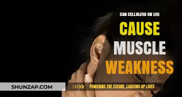Cellulitis and Muscle Weakness: What's the Link?
