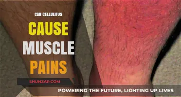 Cellulitis and Muscle Pain: What's the Link?