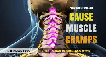 Central Stenosis and Muscle Cramps: Is There a Link?
