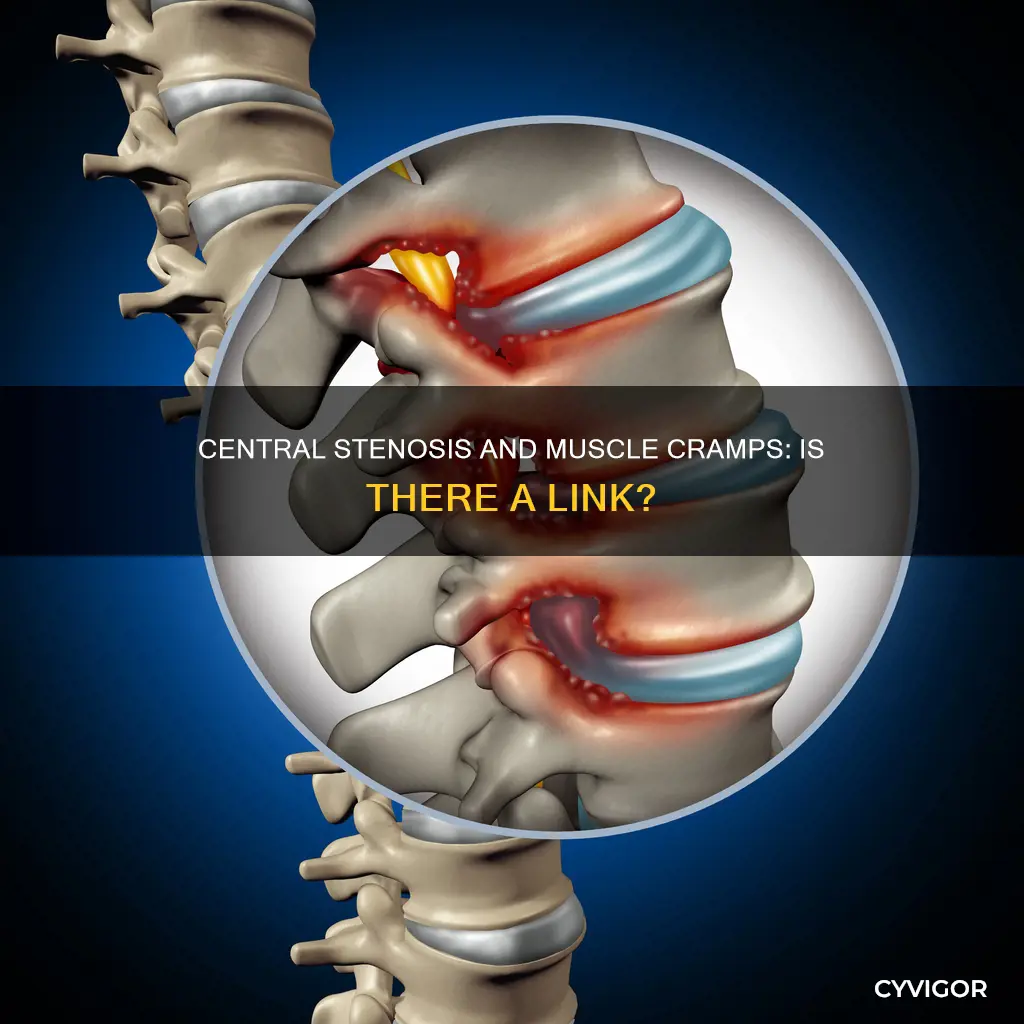 can central stenosis cause muscle cramps