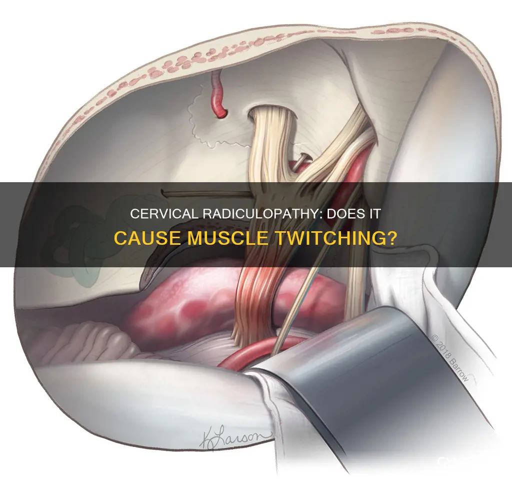 can cervical radiculopathy cause muscle twitching
