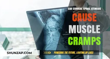Spinal Stenosis and Muscle Cramps: What's the Link?