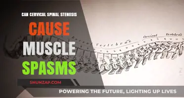 Cervical Spinal Stenosis: Understanding Muscle Spasms