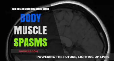 Chiari Malformation: Understanding Muscle Spasms