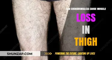 Chondromalacia: Thigh Muscle Loss Explained