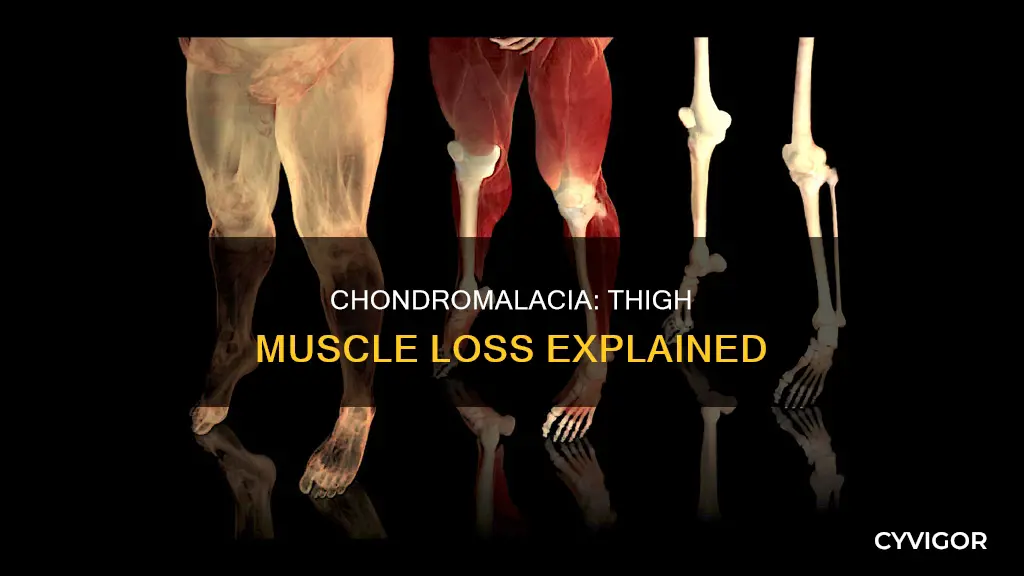 can chondromalcia cause muscle loss in thigh