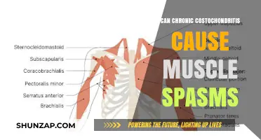 Chronic Costochondritis: Muscle Spasms and Treatment