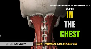 Radiculopathy and Muscle Wasting: What's the Link?