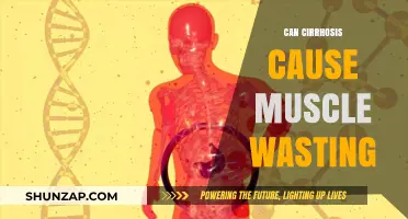 Muscle Wasting: A Symptom of Cirrhosis