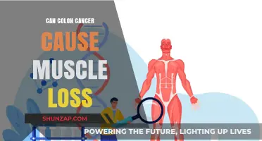 Colon Cancer: Muscle Loss and Its Link