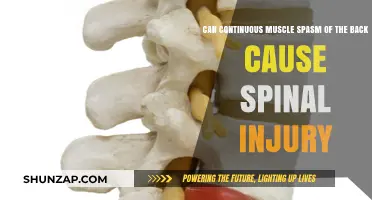 Back Spasms: A Path to Spinal Injury?