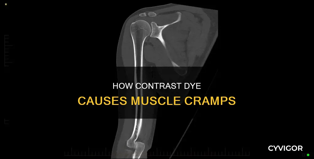 can contrast dye cause muscle cramps