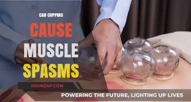 Cupping Therapy: Muscle Spasms and Pain Relief