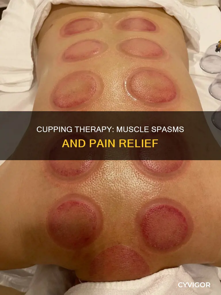 can cupping cause muscle spasms