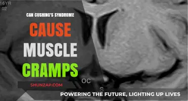 Cushing's Syndrome: Muscle Cramps and Spasms Explained