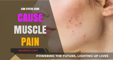 Cystic Acne: Uncovering the Link Between Skin and Muscle Pain