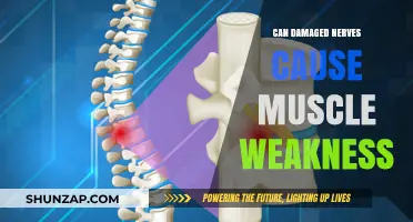 Damaged Nerves: How They Weaken Muscles