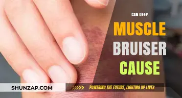 Deep Muscle Bruises: What Are the Causes and Effects?