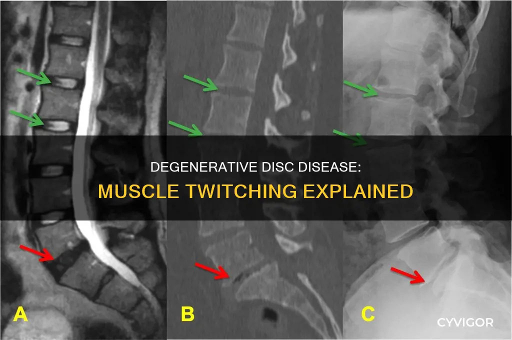 can degenerative disc disease cause muscle twitching