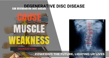 Degenerative Disc Disease: Muscle Weakness and Its Causes