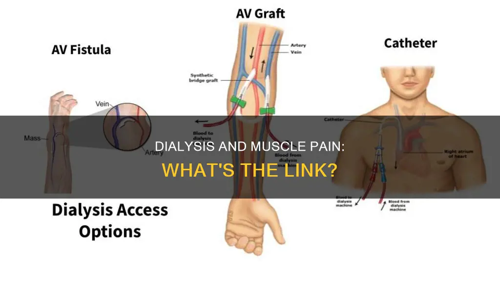 can dialysis cause loss of muscle pain