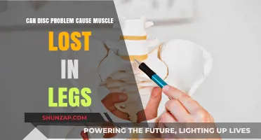 Disc Problems: Leg Muscle Loss Culprit?