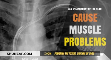 Heart Dyssychrony: Unseen Muscle Problems Revealed