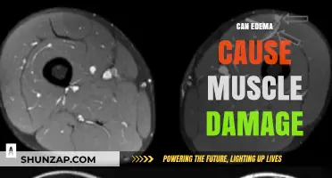 Edema and Muscle Damage: What's the Link?