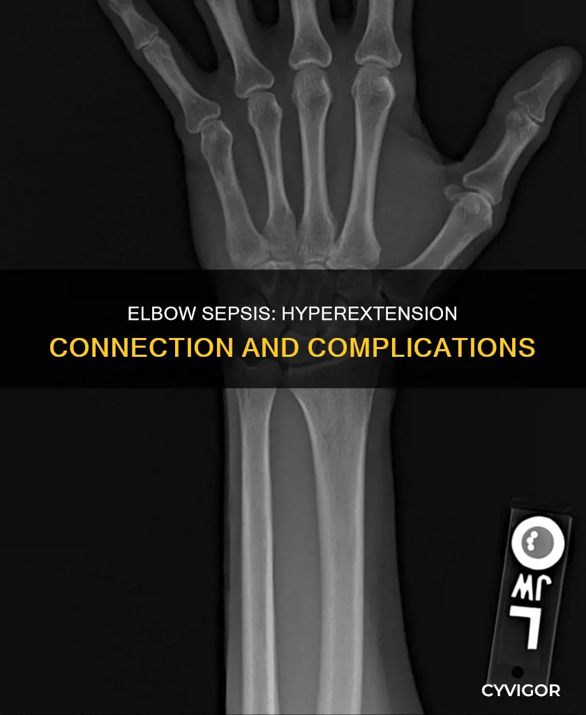 can elbow sepsis be caused by a hyperextended muscle