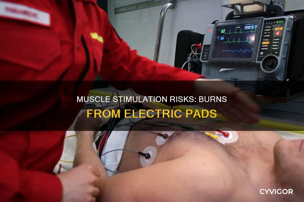 can electronic muscle stimulators cause burns