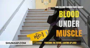 Falling Downstairs: Blood Under the Muscle?